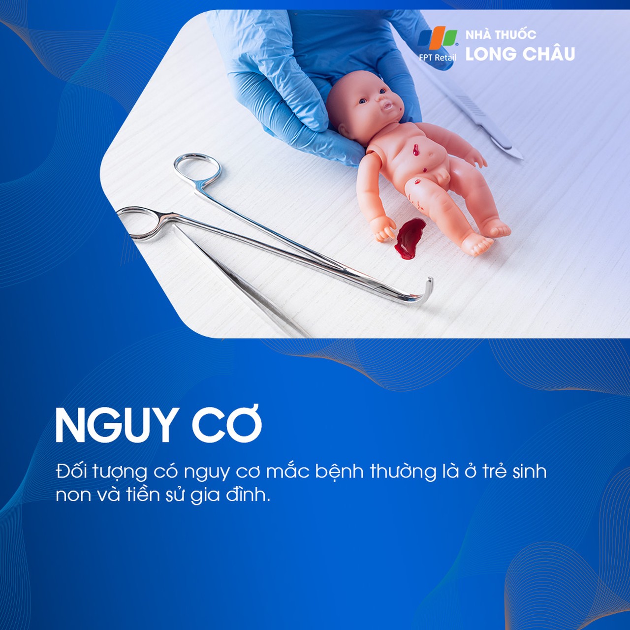 Tinh hoàn lạc chỗ 4