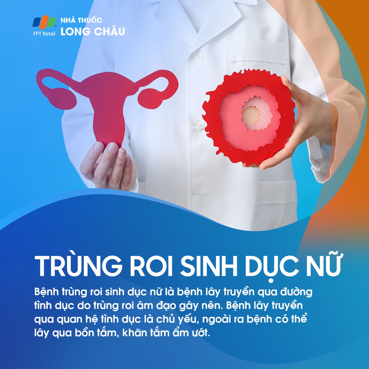 Trùng roi sinh dục nữ 1