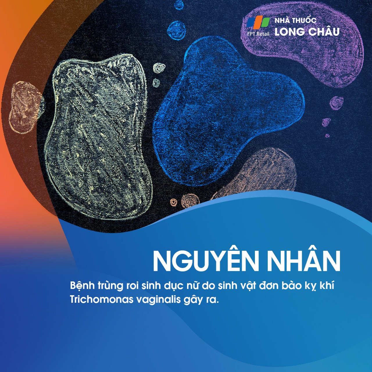 Trùng roi sinh dục nữ 3