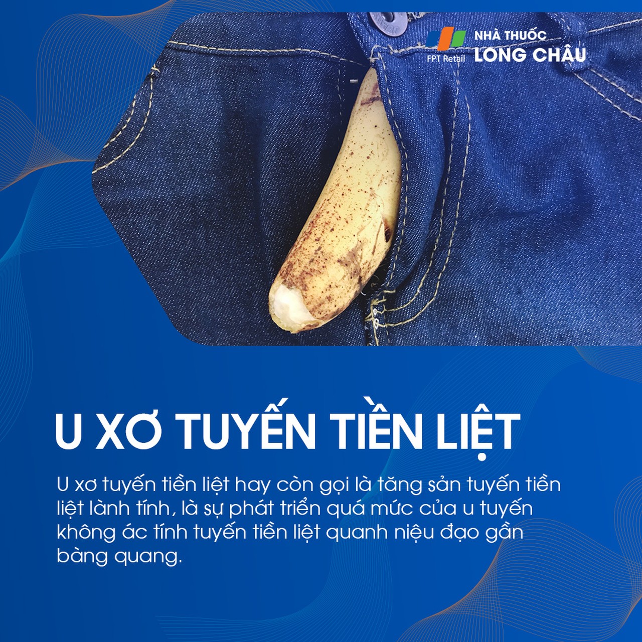 U xơ tuyến tiền liệt 1