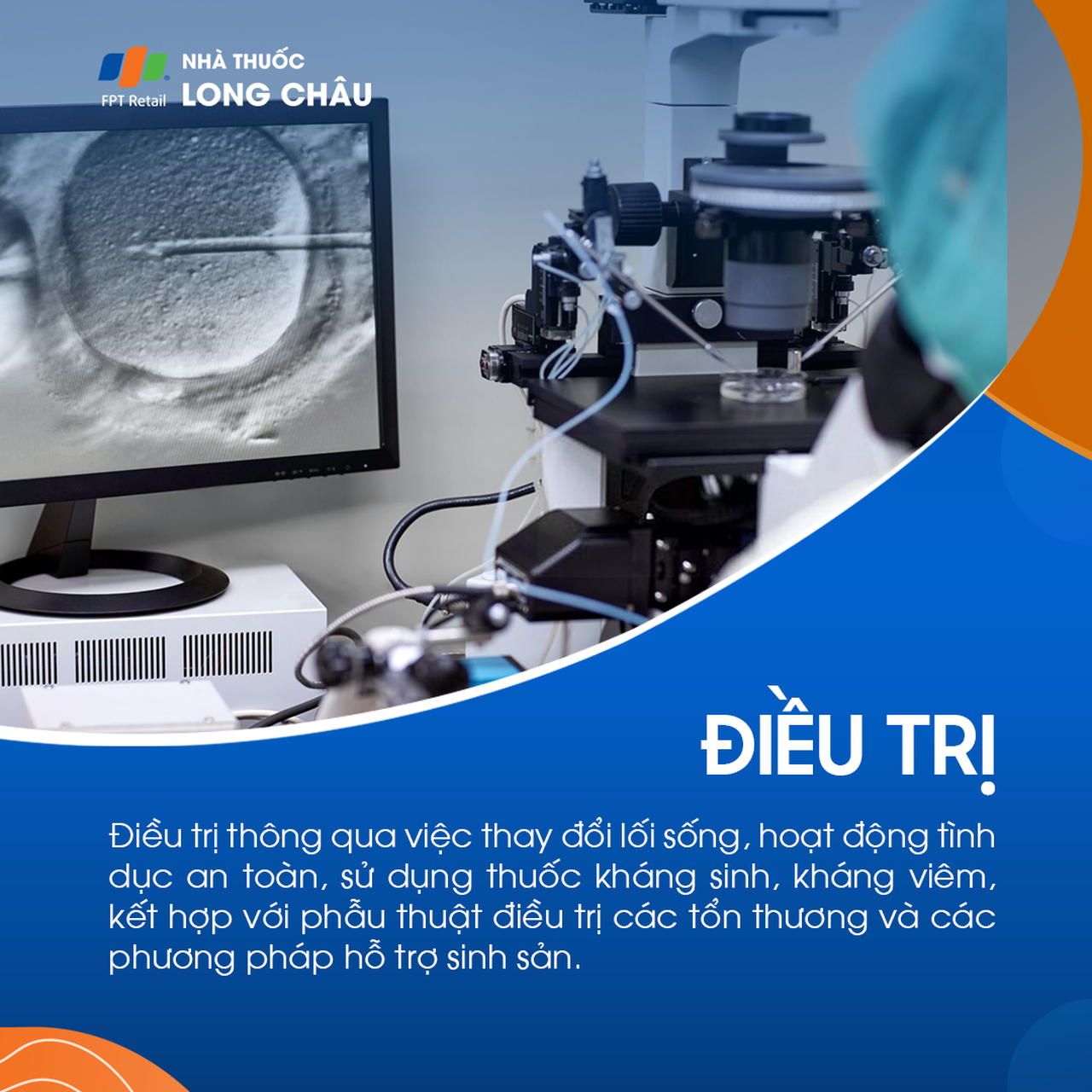 Vô sinh thứ phát 8