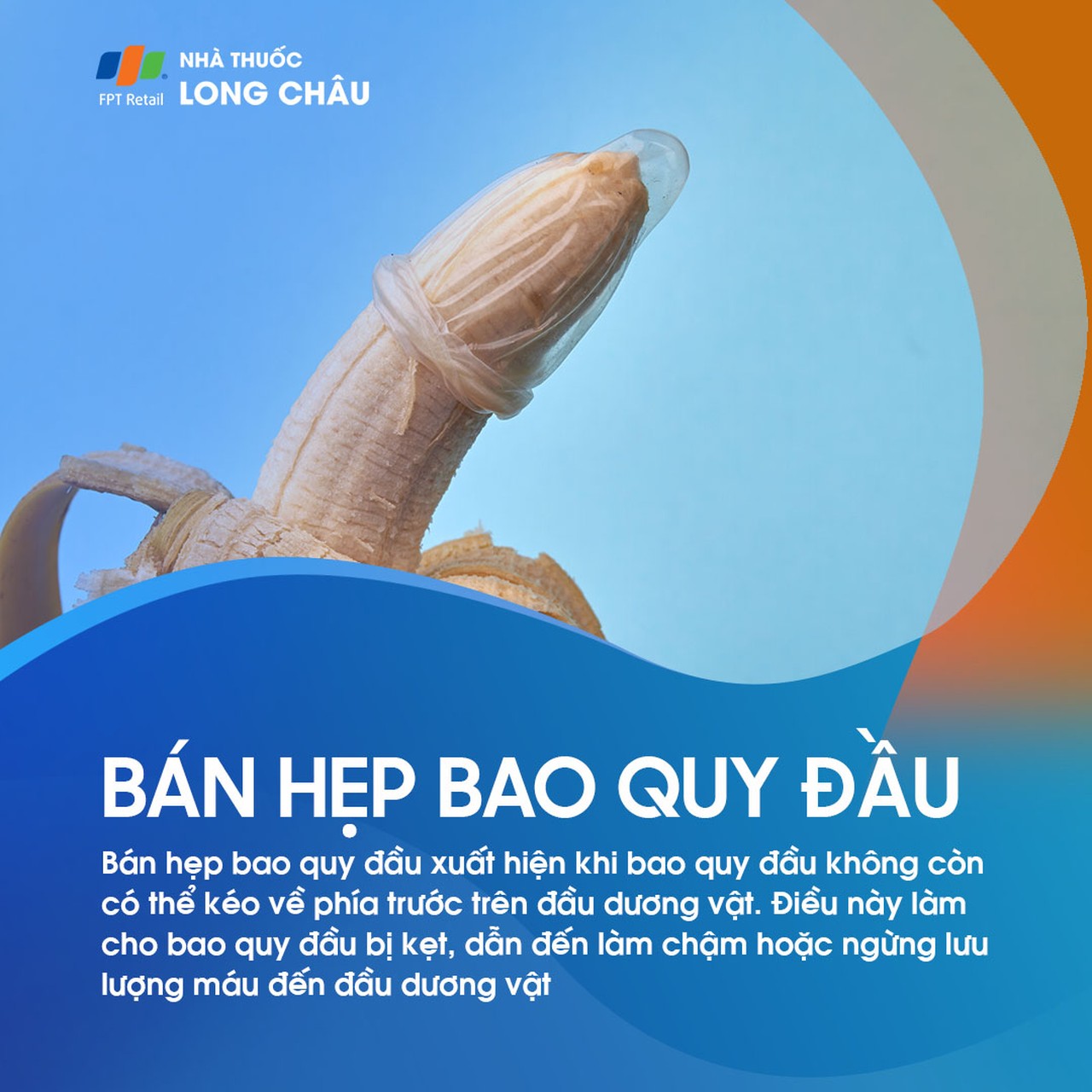 Bán hẹp bao quy đầu xảy ra khi không thể kéo bao quy đầu về phía trước, gây kẹt và cản trở lưu thông máu đến dương vật