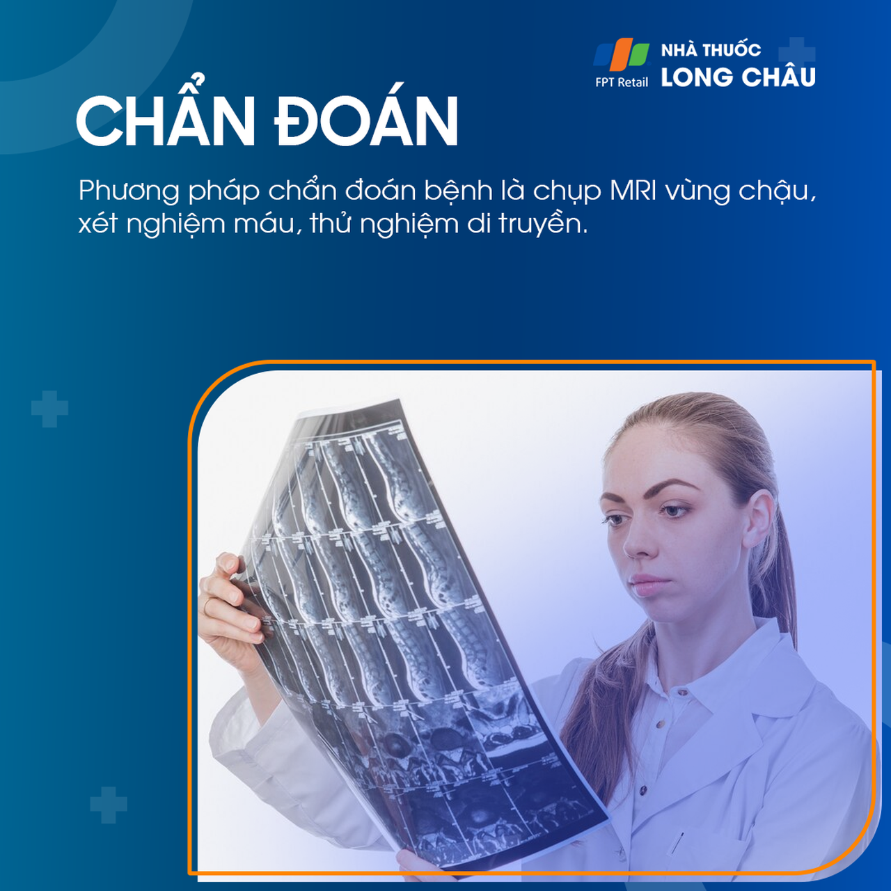 Không có âm đạo 5