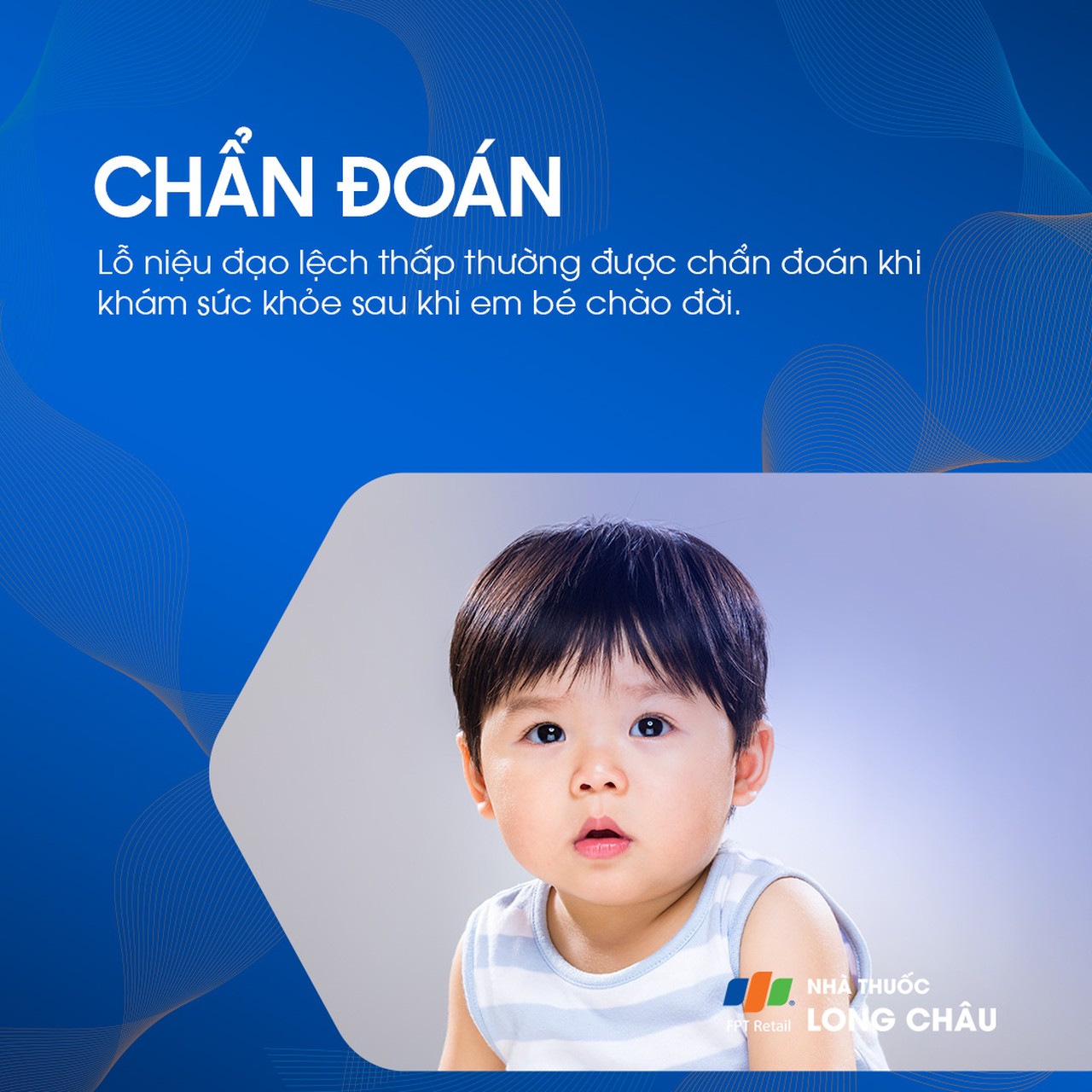 Lỗ tiểu lệch thấp 5