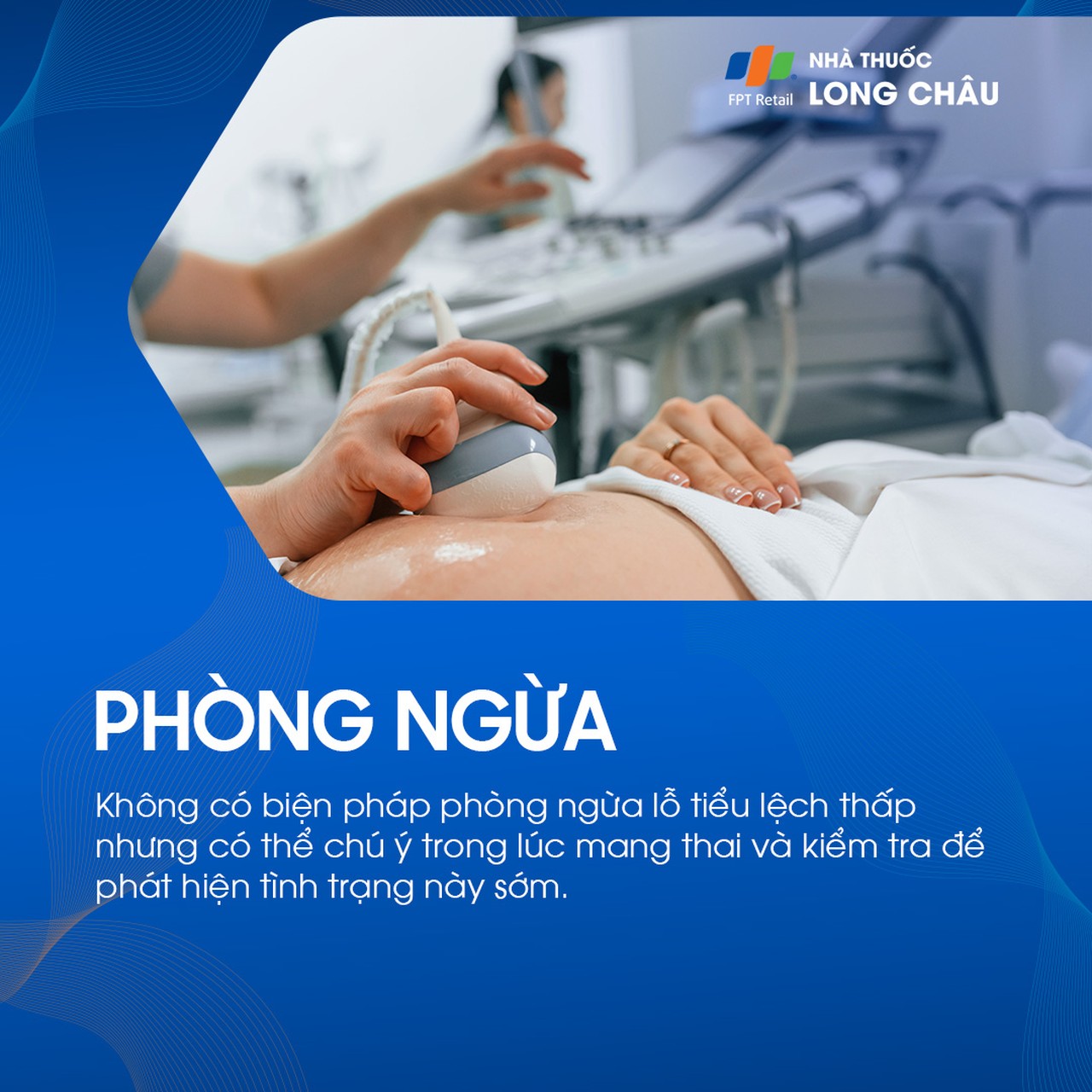 Lỗ tiểu lệch thấp 7