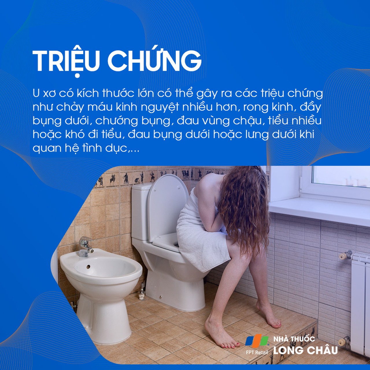 U cơ trơn tử cung 2