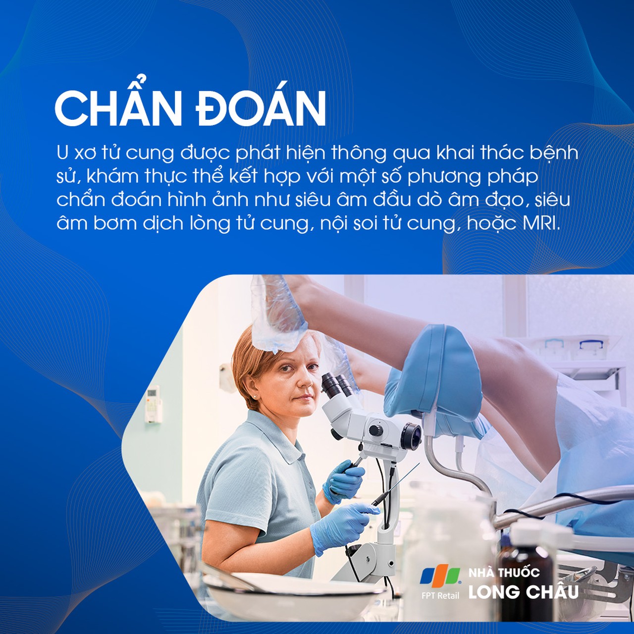 U cơ trơn tử cung 5