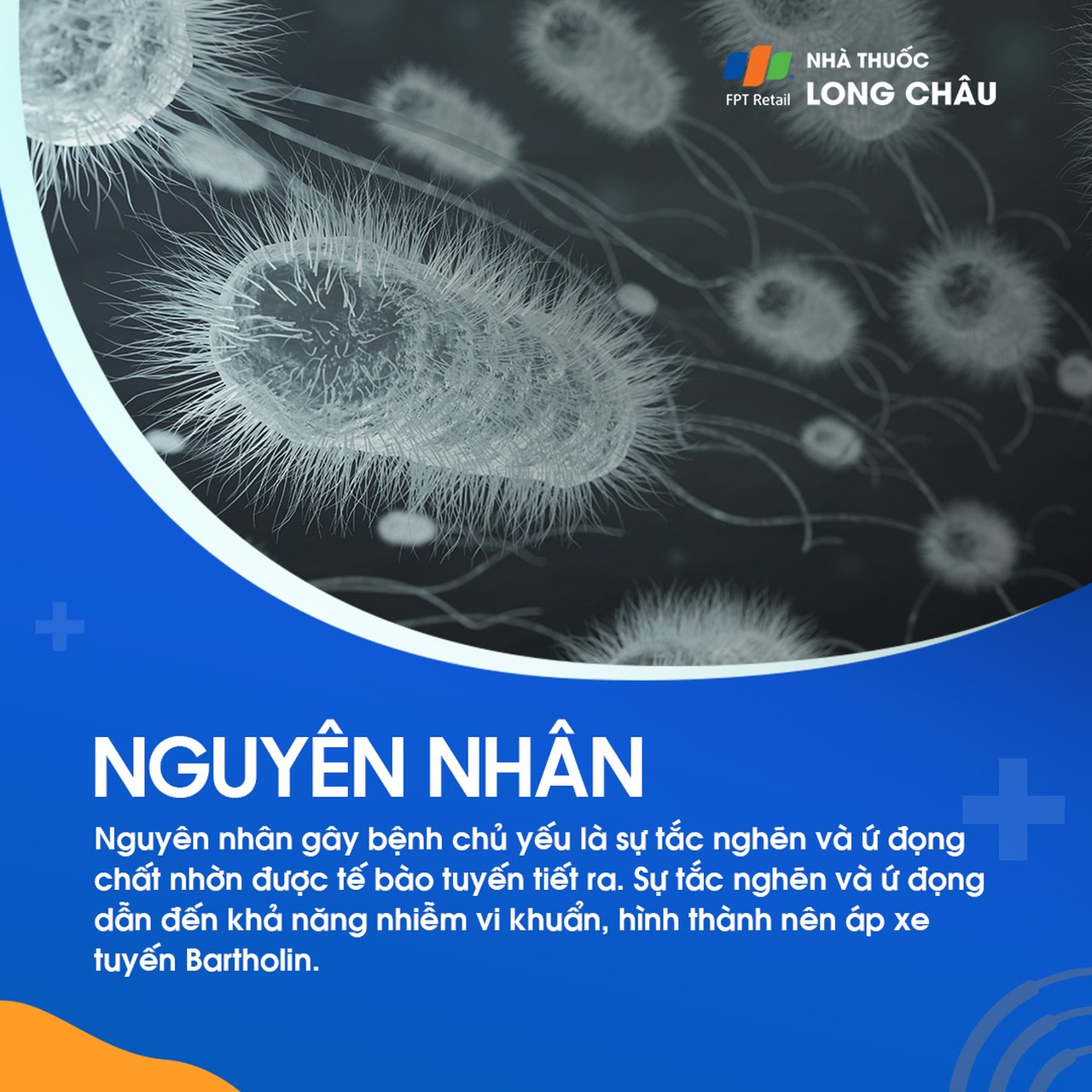 U nang tuyến Bartholin 3