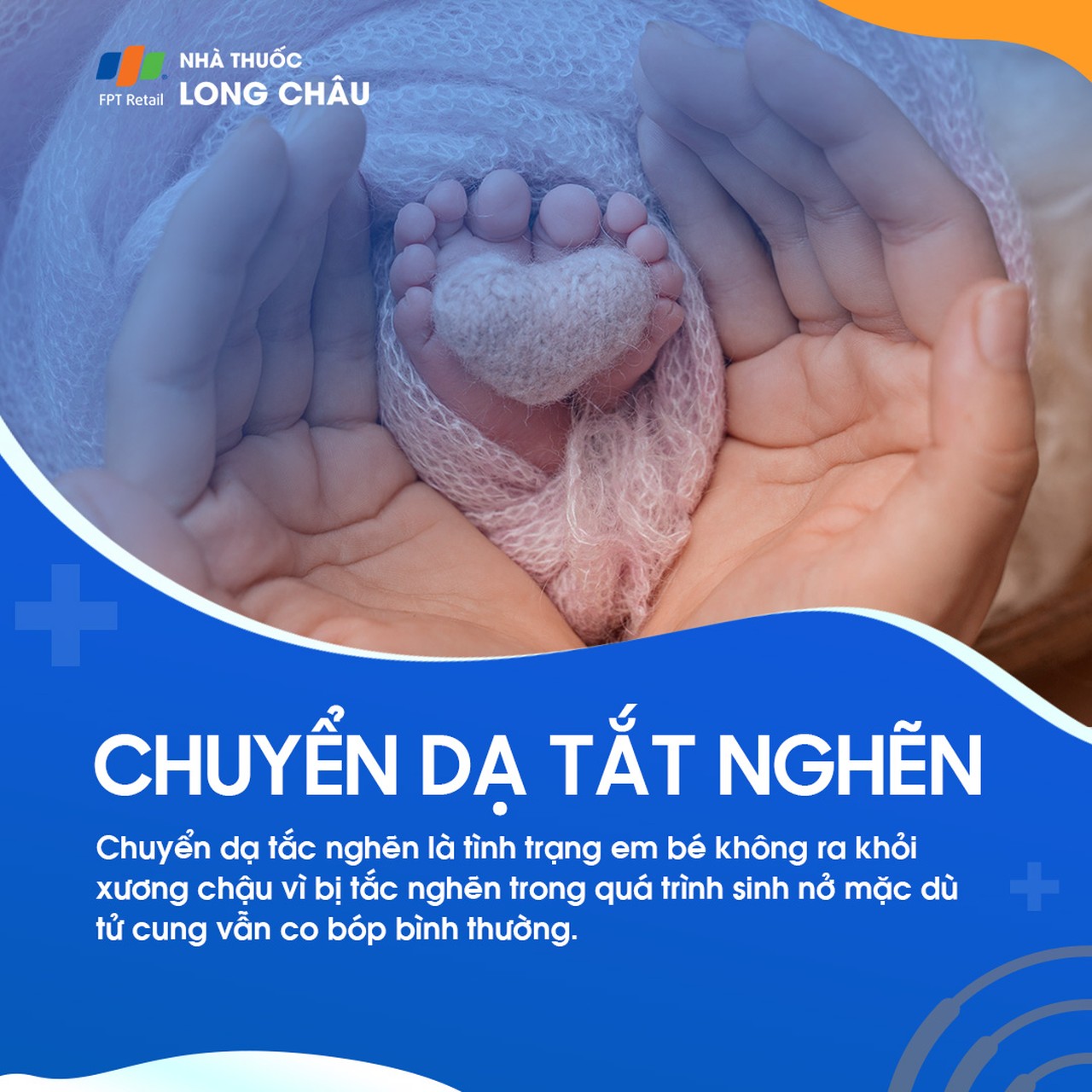 Chuyển dạ đình trệ 2