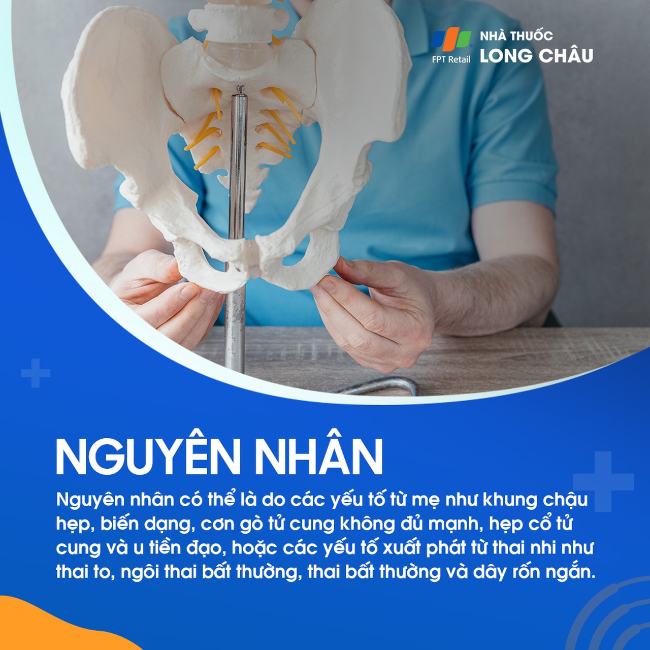 Chuyển dạ đình trệ 5