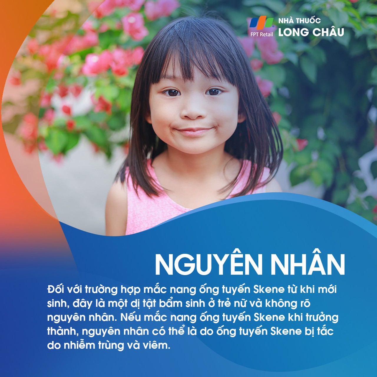Nang ống tuyến Skene 3