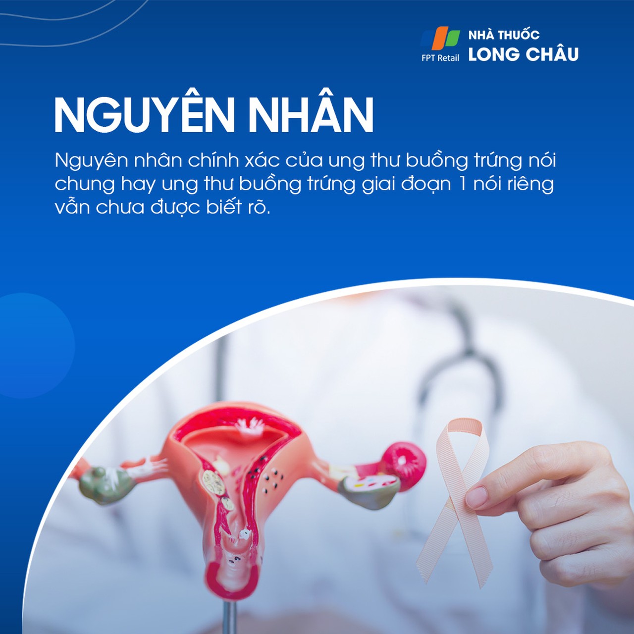 Ung thư buồng trứng giai đoạn 1 - 3