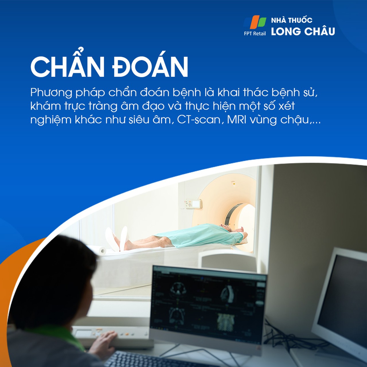 Ung thư buồng trứng giai đoạn 1 - 5