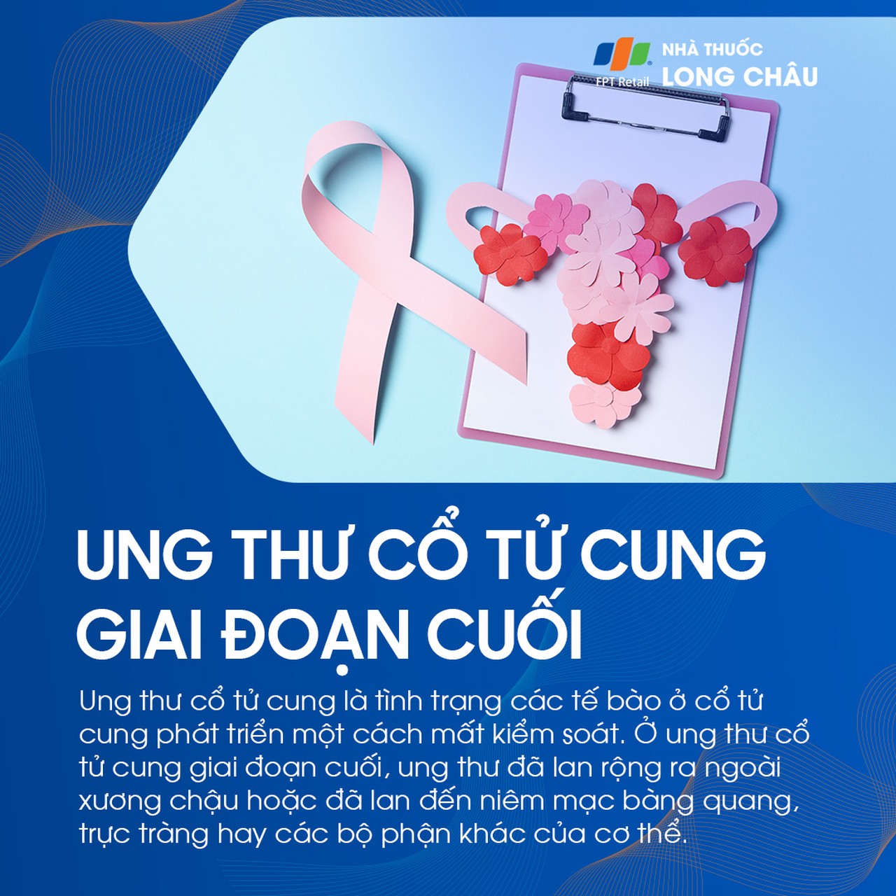 Ung thư cổ tử cung giai đoạn cuối 1