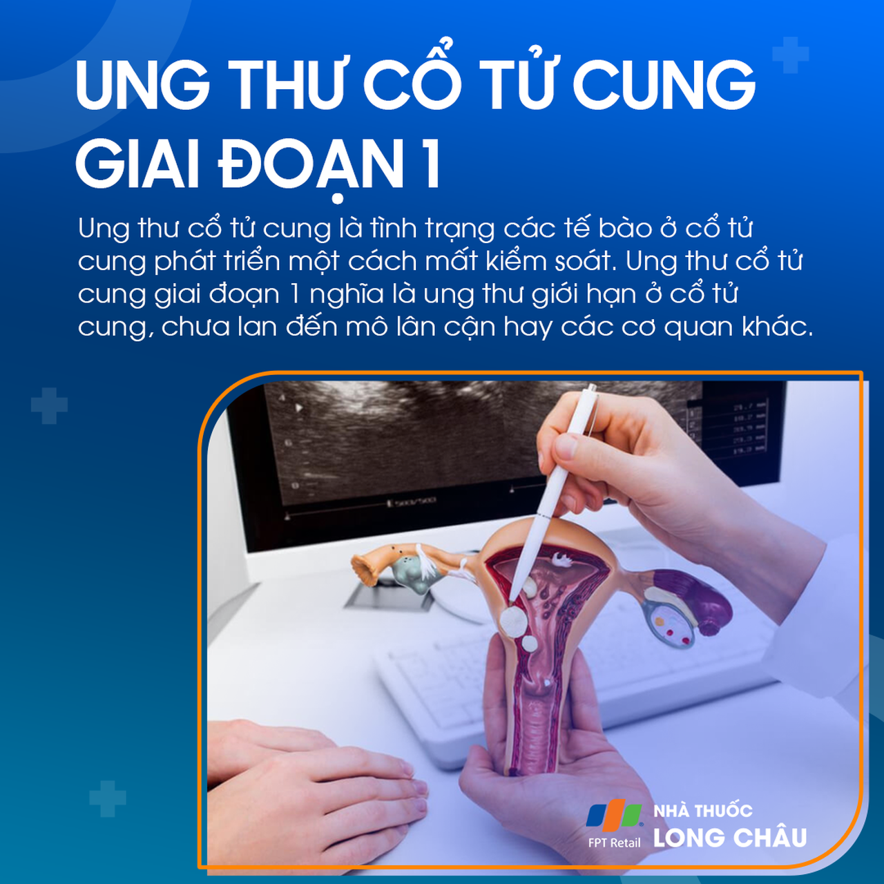 Ung thư cổ tử cung giai đoạn 1 - 1