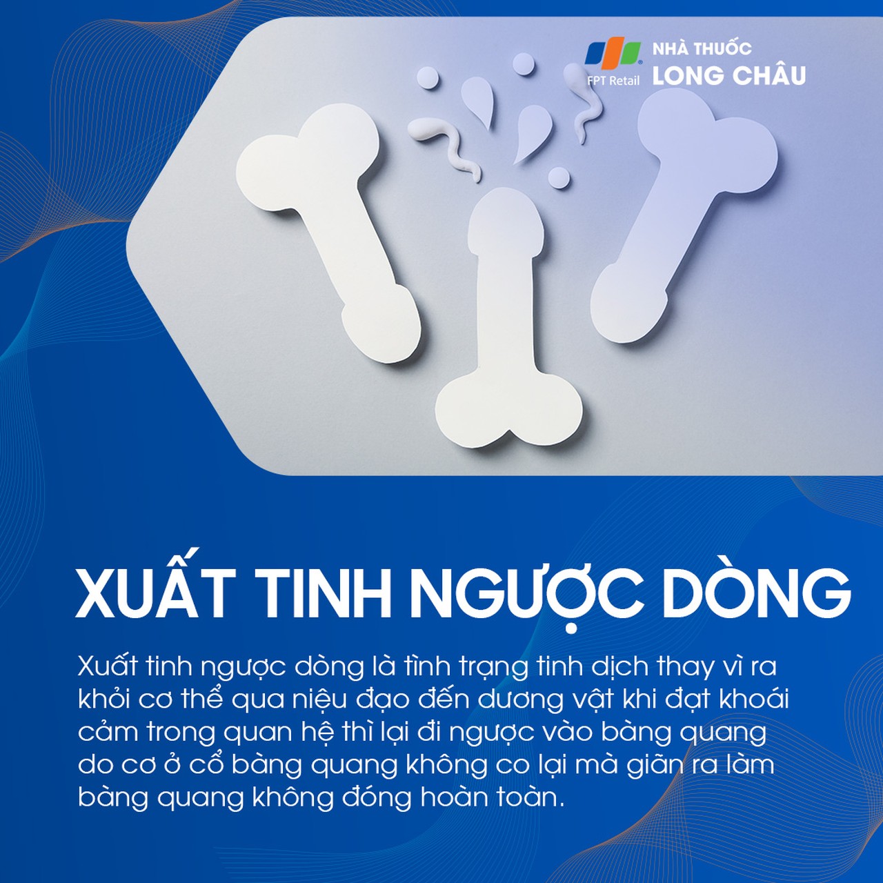 Xuất tinh ngược dòng 1