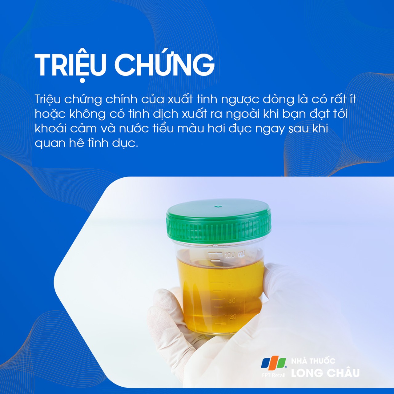 Xuất tinh ngược dòng 2