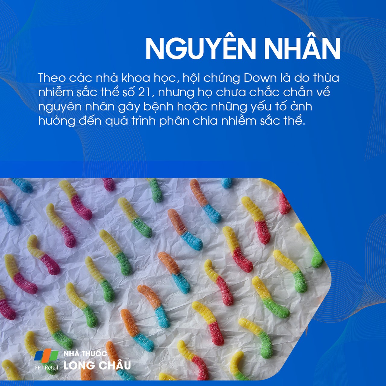 Hội chứng Down 3