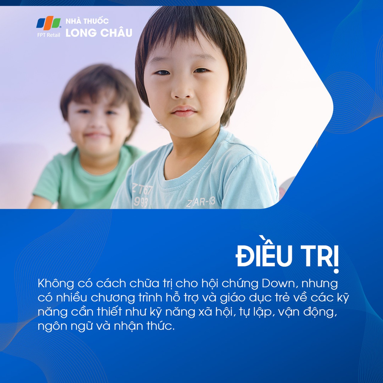 Hội chứng Down 7