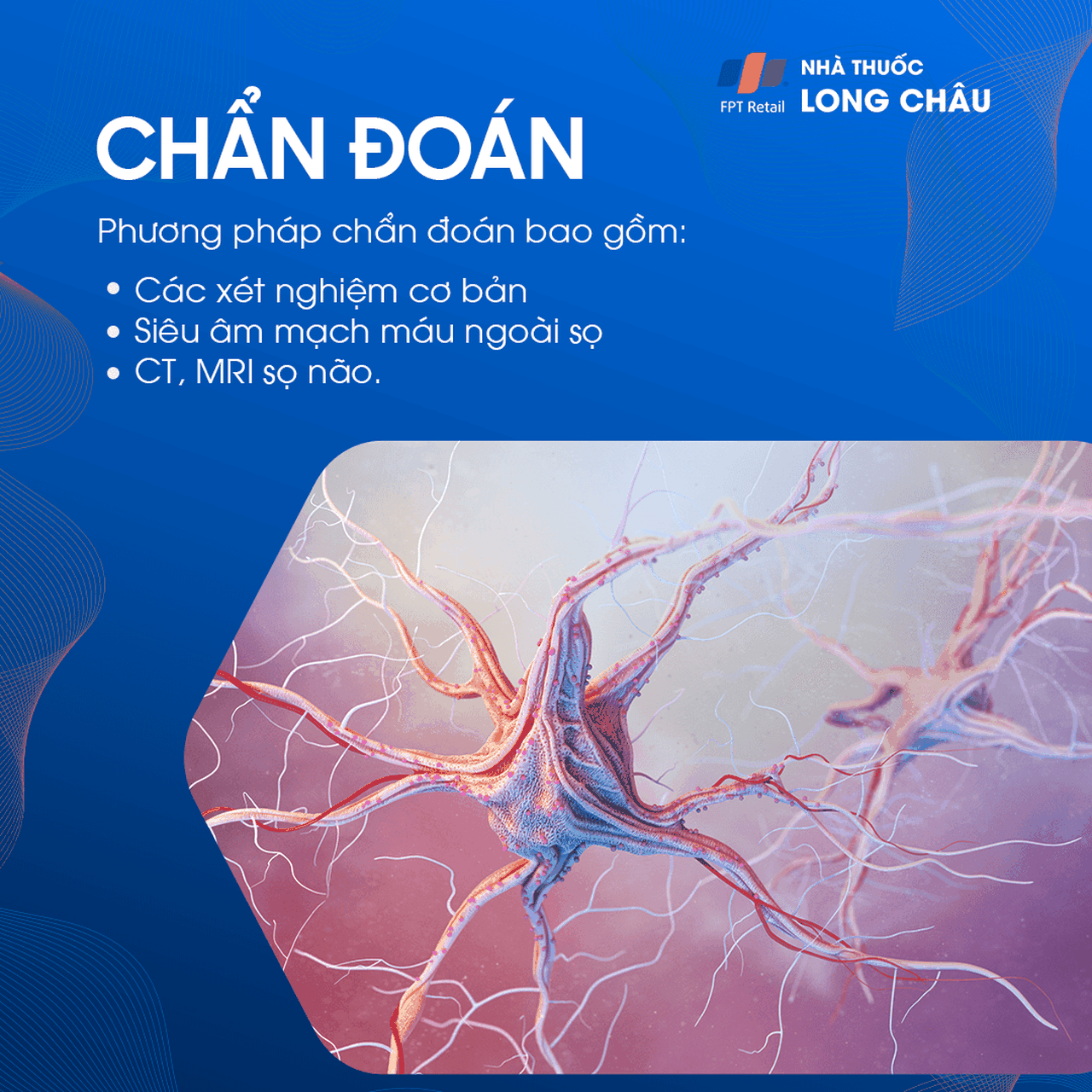 Chẩn đoán rối loạn tiền đình thông qua xét nghiệm thăng bằng và kiểm tra tai trong