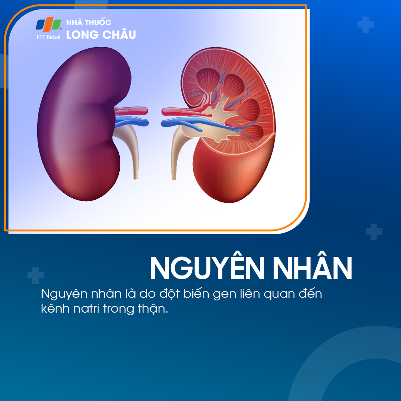 Hội chứng liddle 3