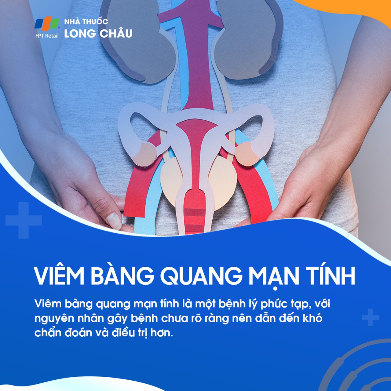 Viêm bàng quang mạn tính 1