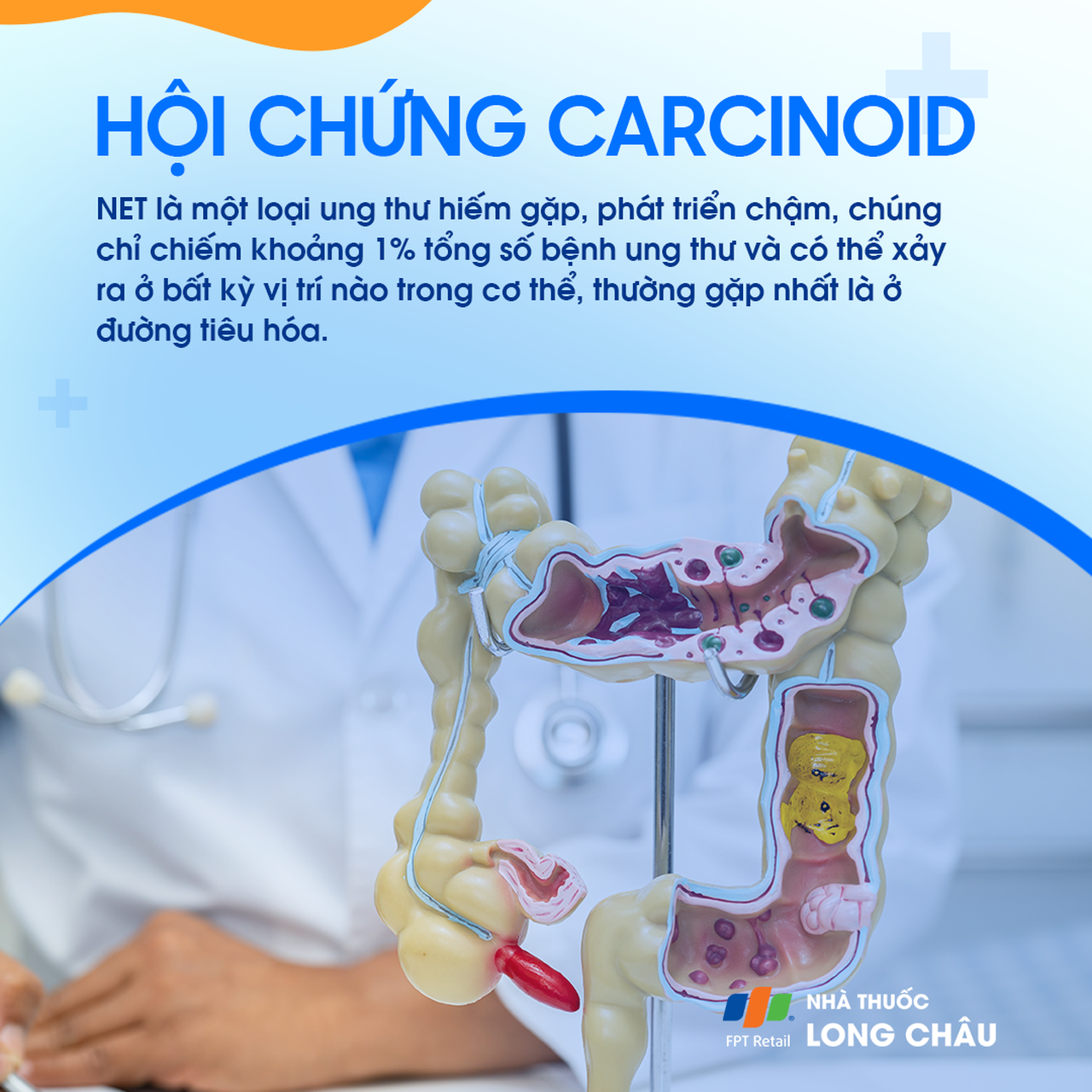 Hội chứng carcinoid 2
