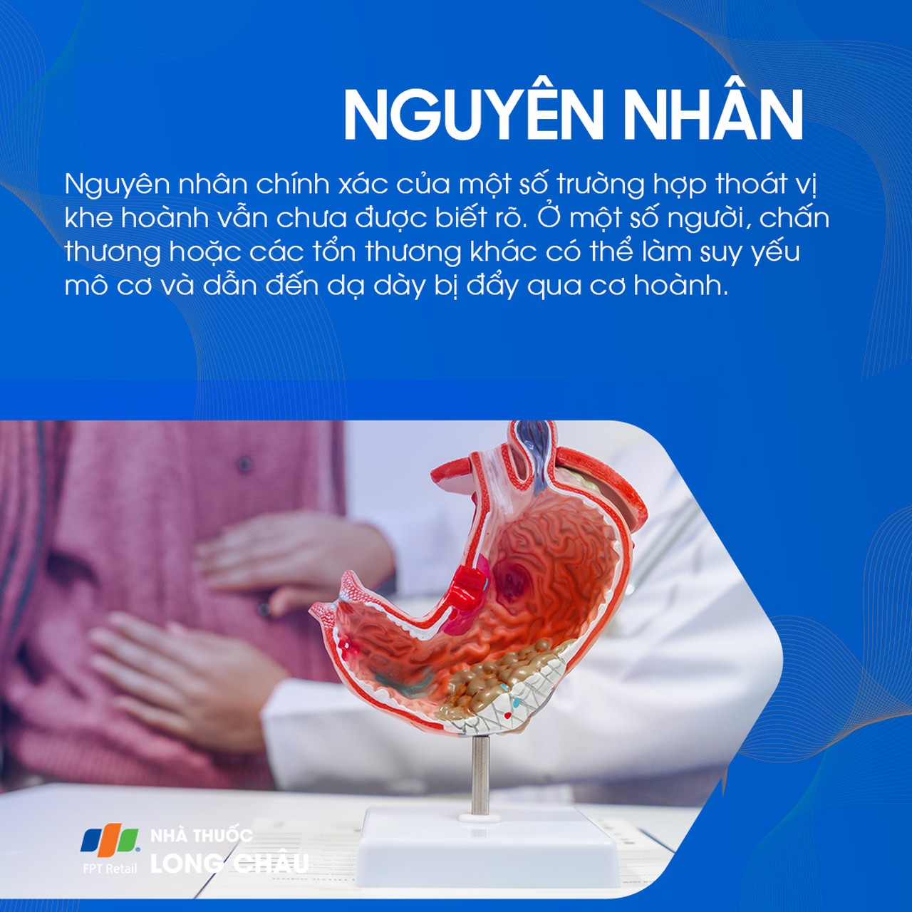 Thoát vị khe hoành 3