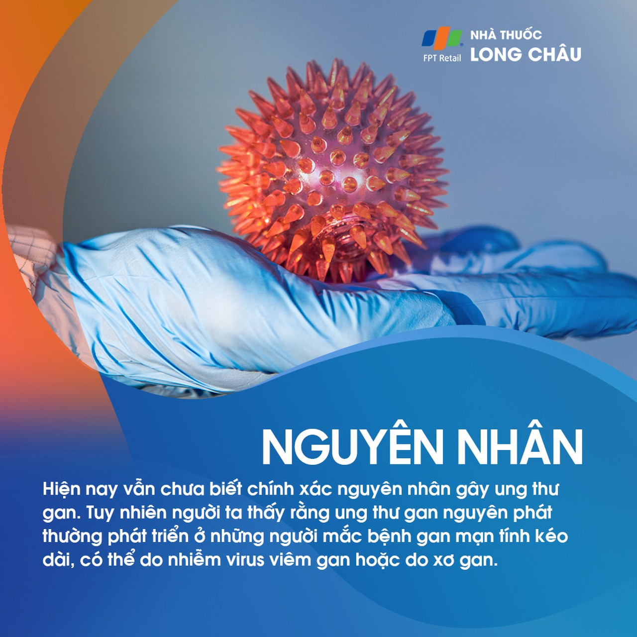 Ung thư gan nguyên phát 3