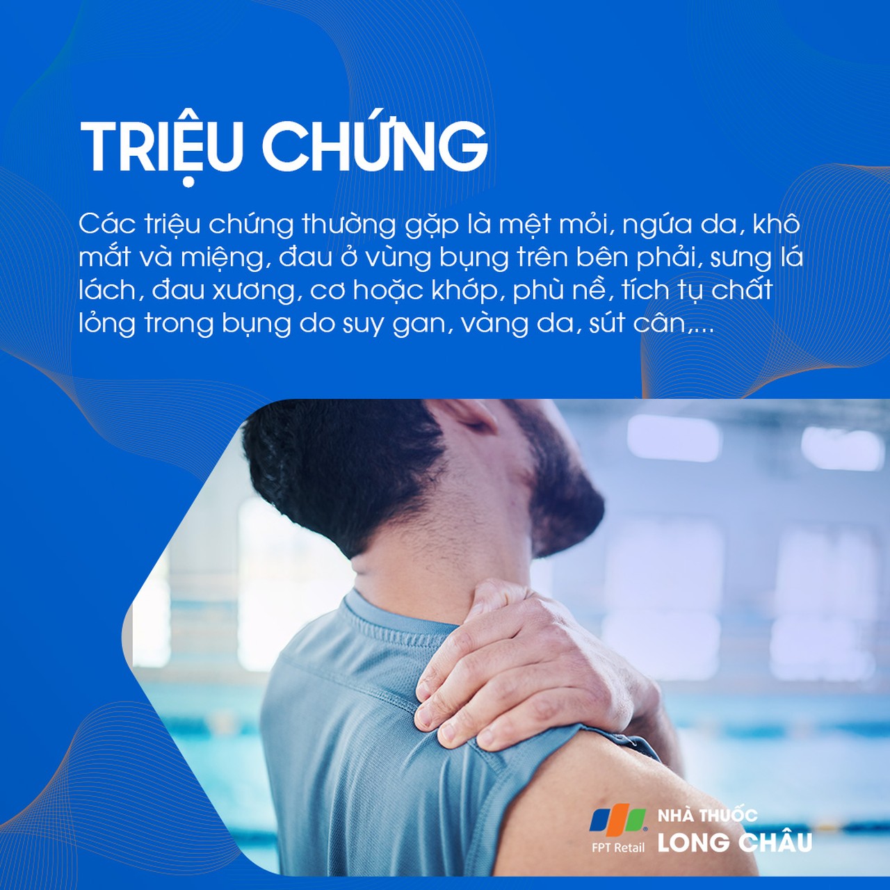 Viêm đường mật nguyên phát 2