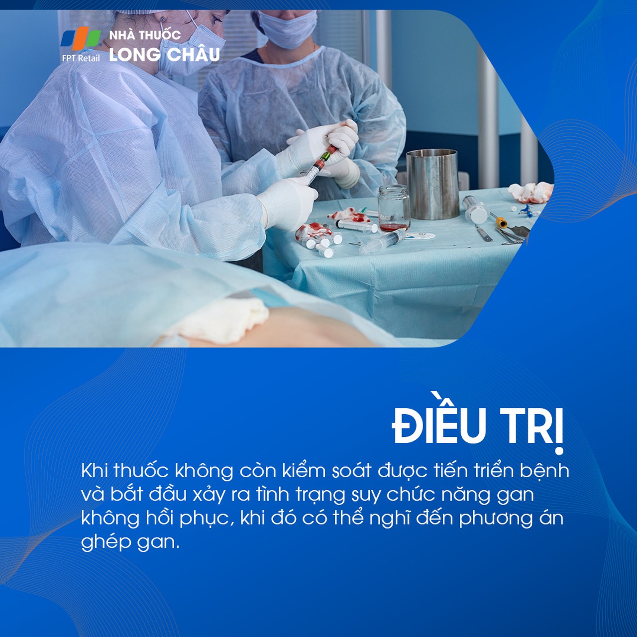 Viêm đường mật nguyên phát 7