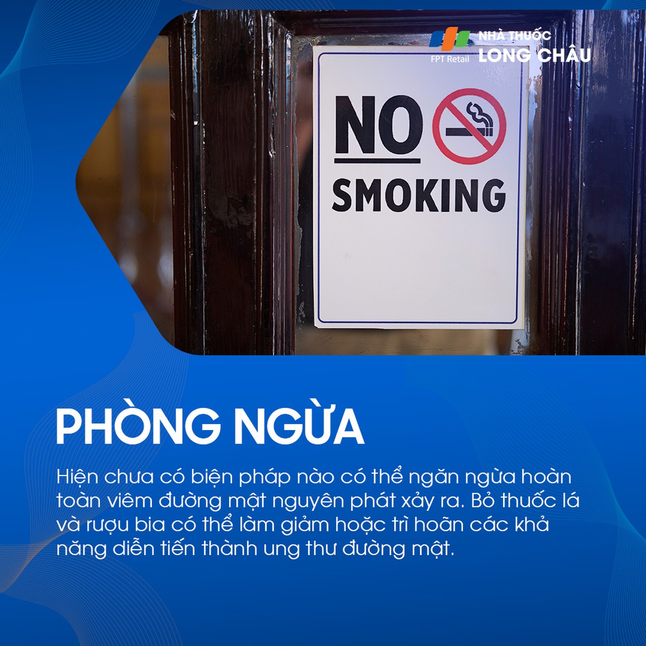 Viêm đường mật nguyên phát 8