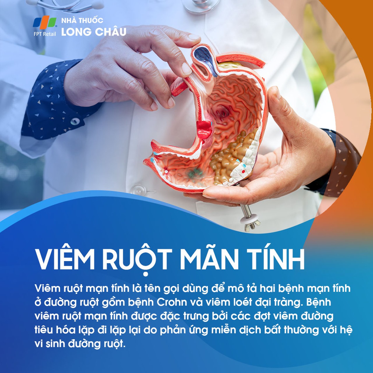 Virm ruột mạn tính 1