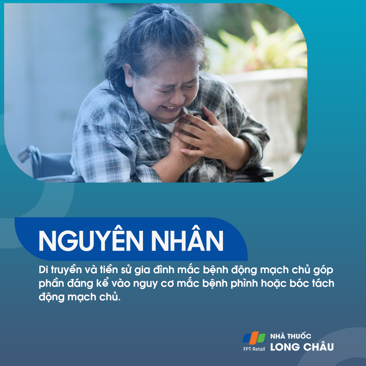 Nguy cơ di truyền bệnh động mạch chủ