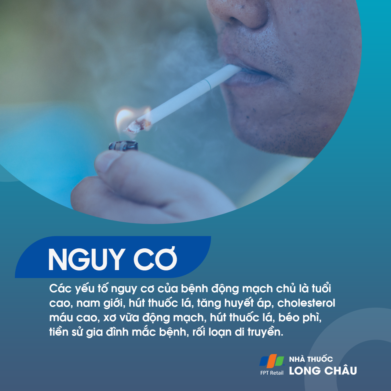 Yếu tố nguy cơ gây bệnh động mạch chủ như tăng huyết áp, xơ vữa, cholesterol cao