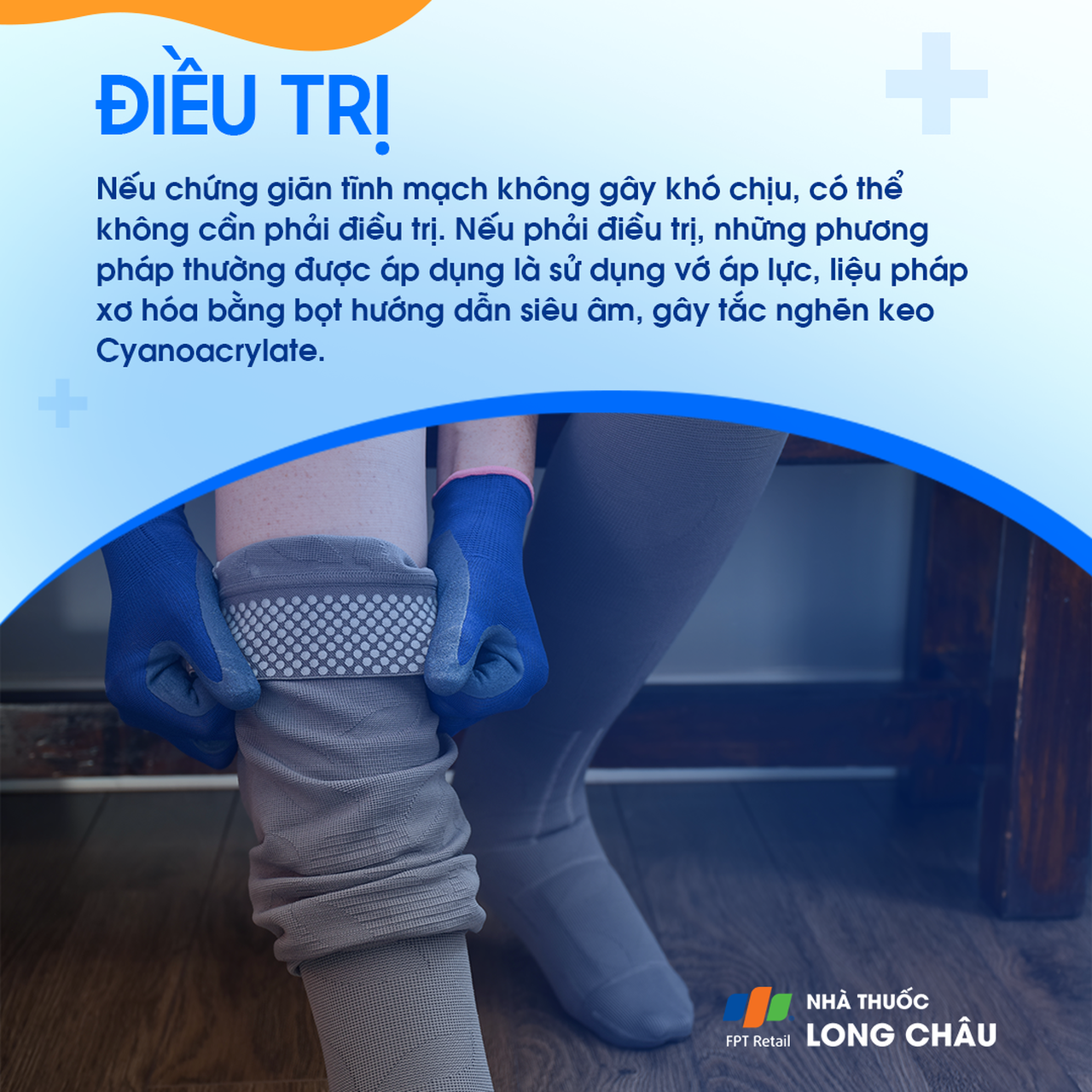 Giãn tĩnh mạch 7