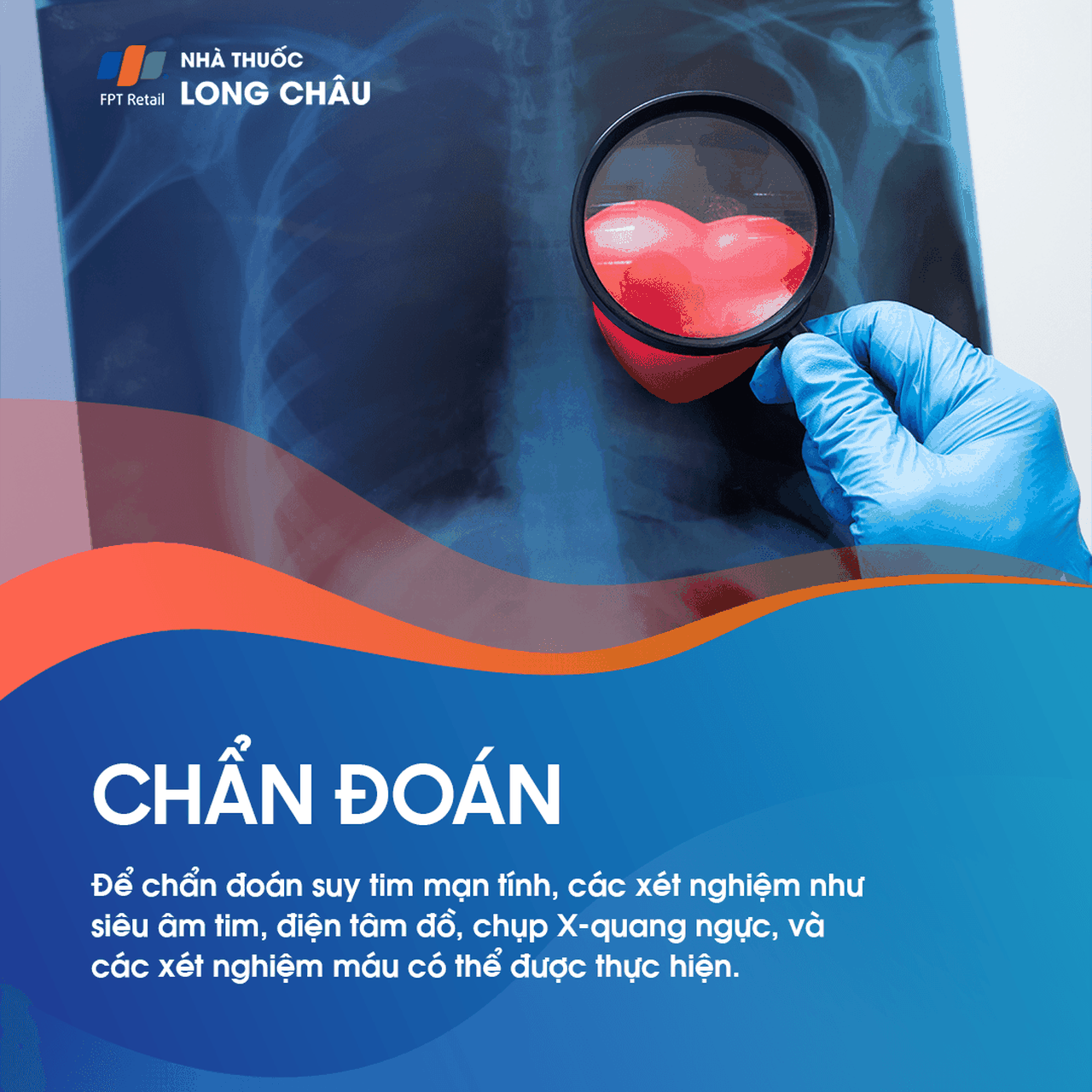 Suy tim mạn tính 5