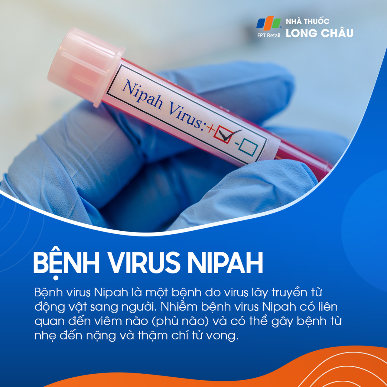 Virus nipah 1