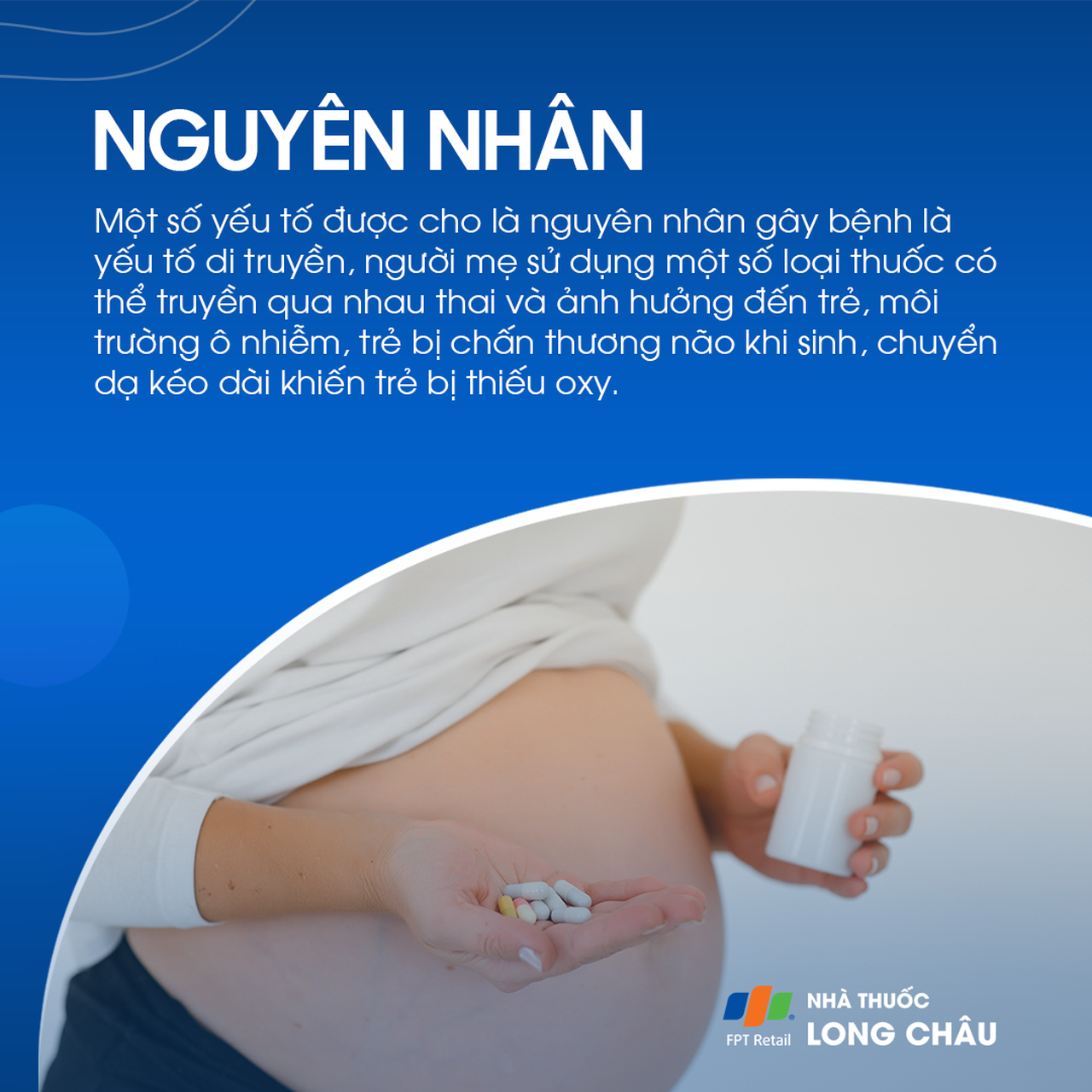 Rối loạn phát triển lan tỏa 3