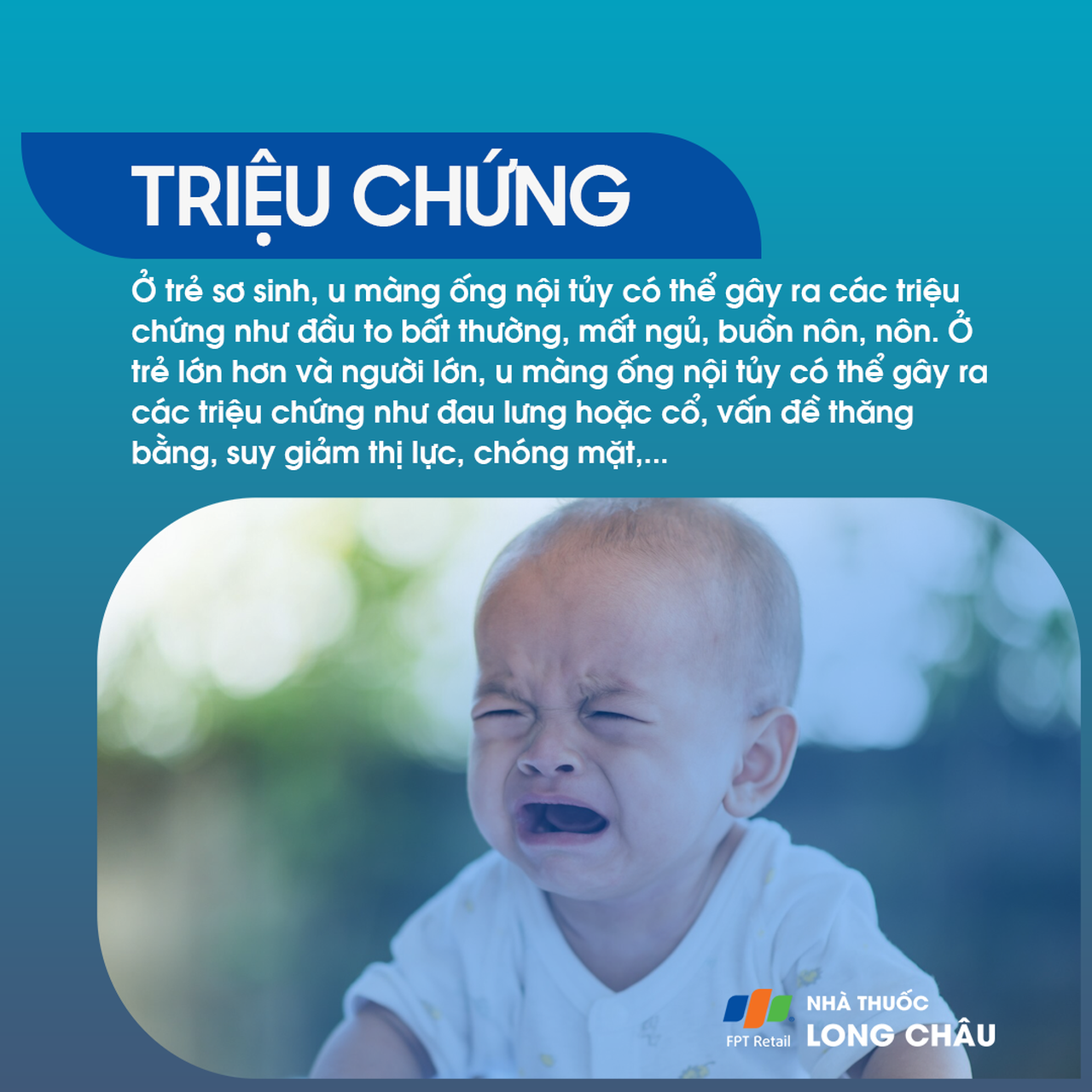 U màng ống nội tủy 2