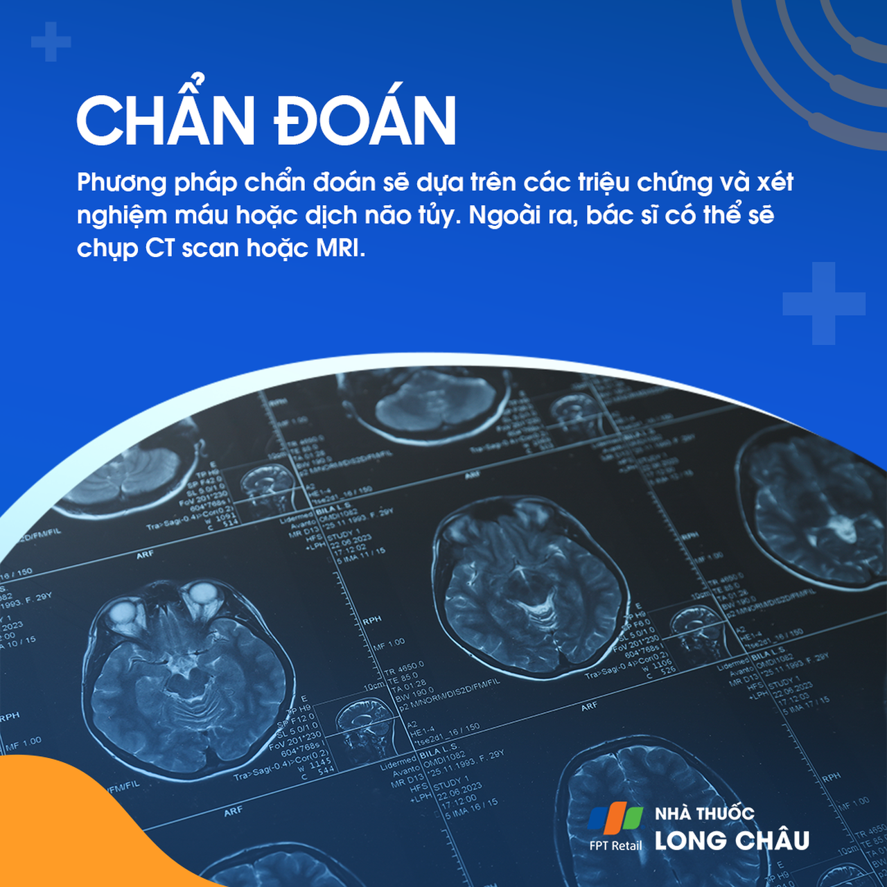 Viêm màng não do tăng bạch cầu ái toan 6