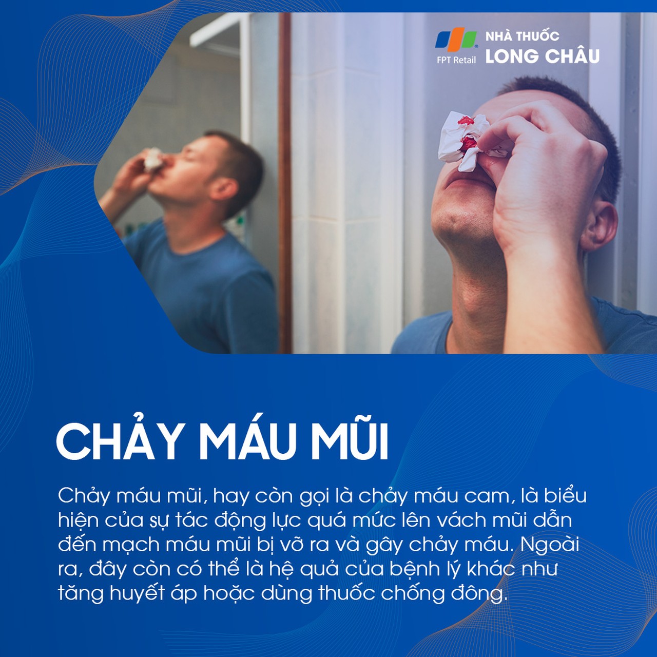 Chảy máu mũi do tác động làm vỡ mạch máu ở vách mũi, có thể do bệnh lý như tăng huyết áp hoặc dùng thuốc chống đông