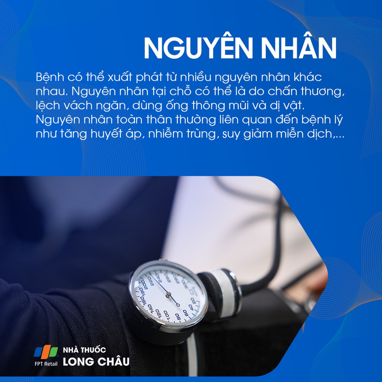 Gồm chấn thương mũi, lệch vách ngăn, dị vật hoặc dùng ống thông mũi gây tổn thương mạch máu.