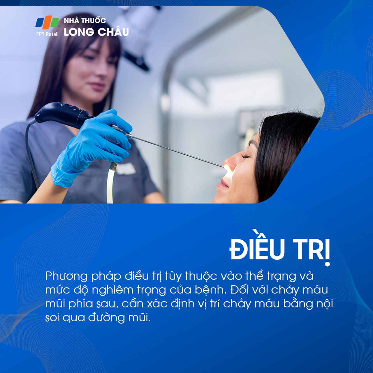 Cần nội soi để xác định vị trí chảy máu và điều trị đúng theo mức độ nghiêm trọng