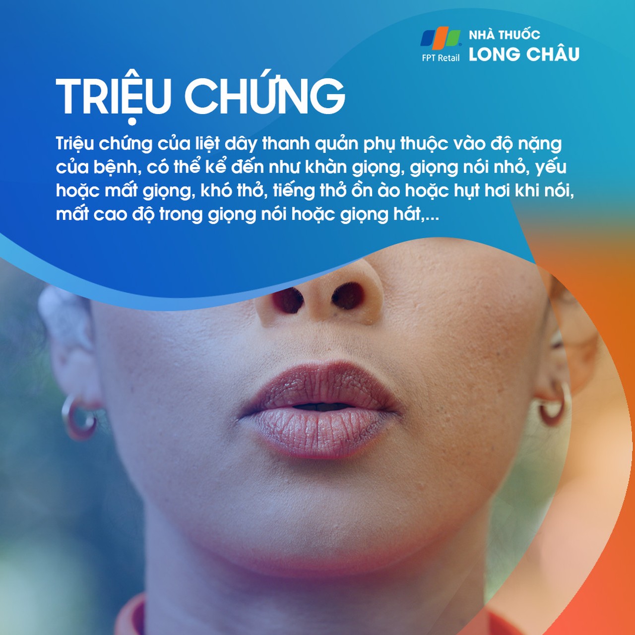 Liệt dây thanh quản 2