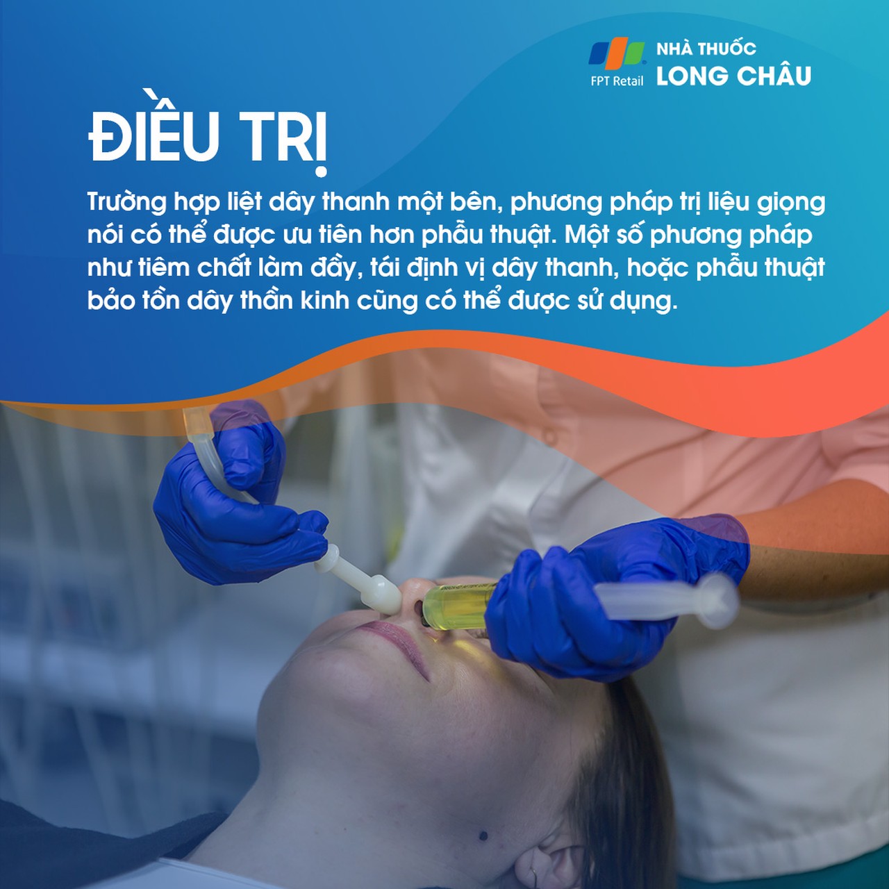 Liệt dây thanh quản 6