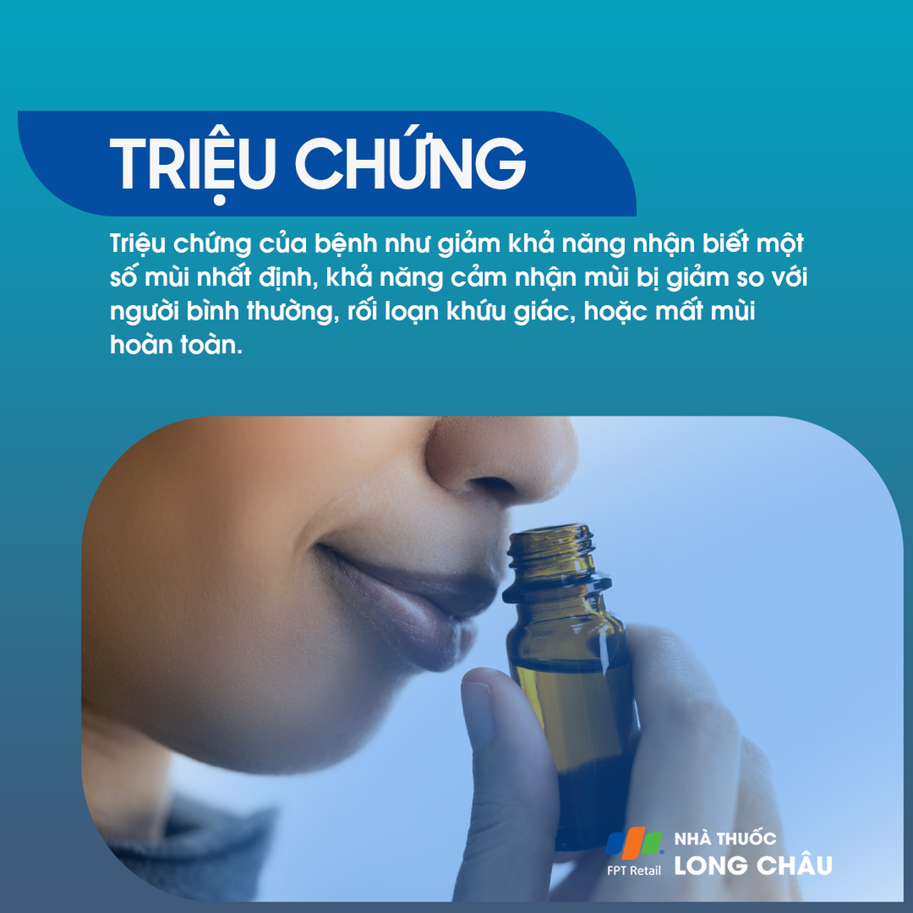 Liệt dây thần kinh khứu giác 2