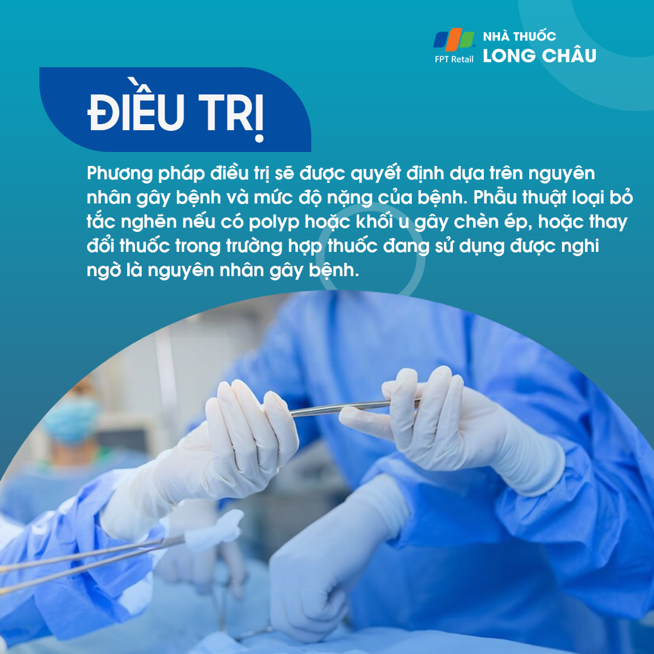 Liệt dây thần kinh khứu giác 6