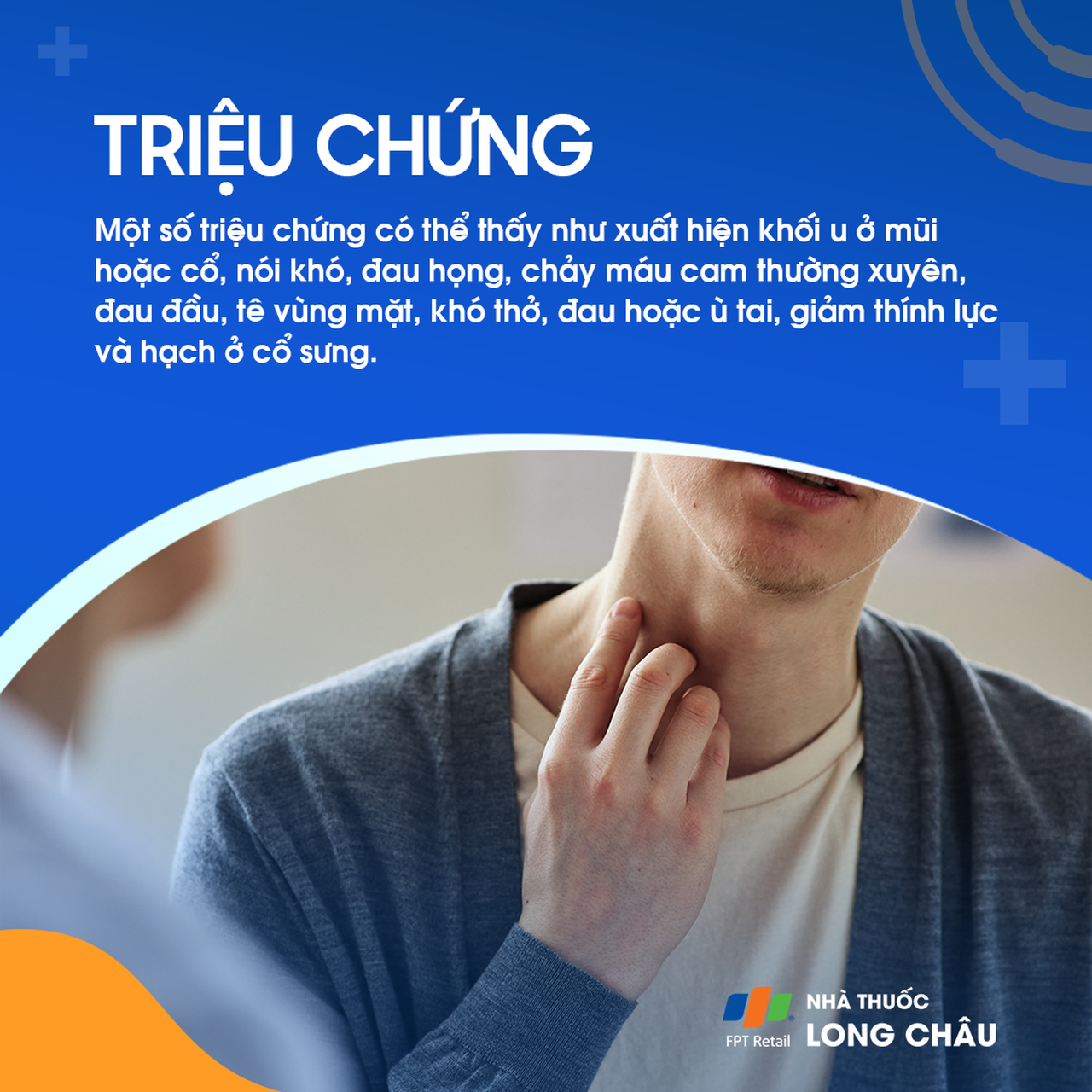 Ung thư vòm họng giai đoạn 1 - 3