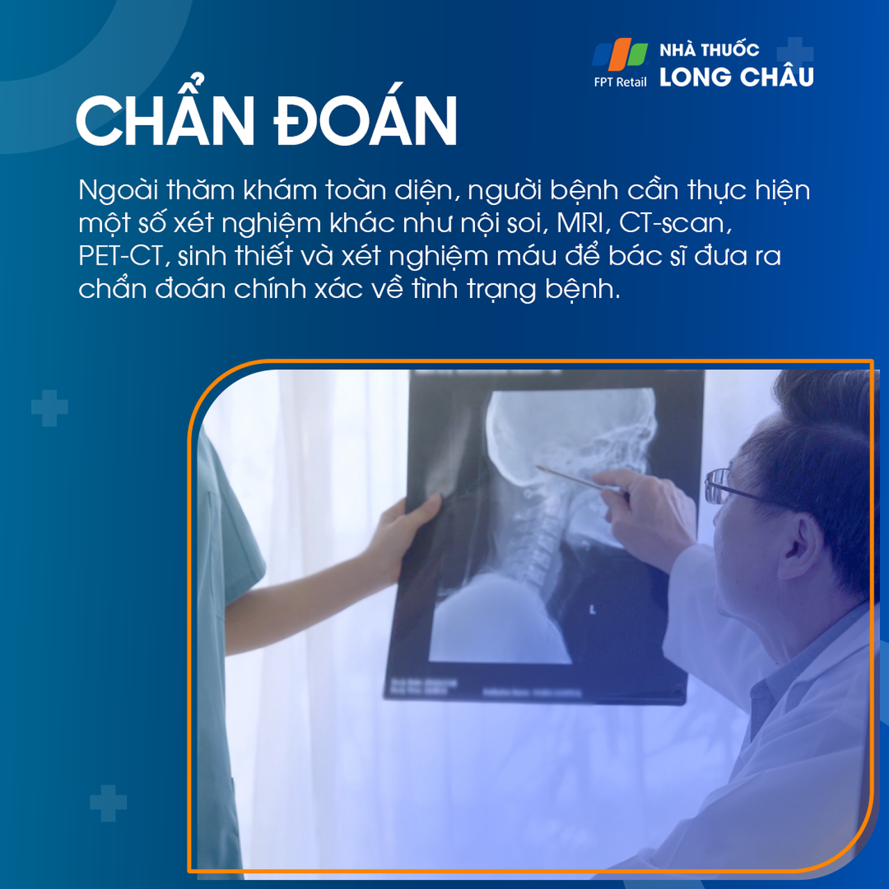 Ung thư vòm họng giai đoạn 3 - 5